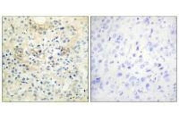Anoctamin 7 抗体  (C-Term)