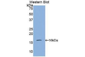 Western blot analysis of the recombinant protein. (VPREB1 抗体  (AA 43-134))