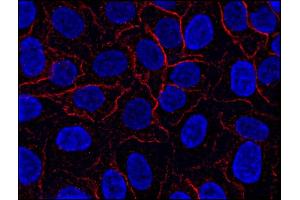 Immunocytochemistry staining of AHNAK1 in HeLa cell line using anti-AHNAK1 (EM-09, red).