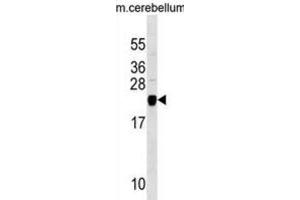 Western Blotting (WB) image for anti-Transgelin 3 (TAGLN3) antibody (ABIN3000208) (Transgelin 3 抗体)