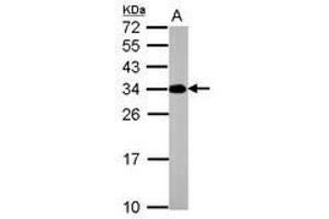 Image no. 1 for anti-ATPase, H+ Transporting, Lysosomal 31kDa, V1 Subunit E2 (ATP6V1E2) antibody (ABIN1502161) (ATP6V1E2 抗体)