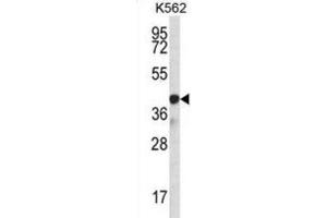 Western Blotting (WB) image for anti-Sp6 Transcription Factor (SP6) antibody (ABIN2997083) (SP6 抗体)