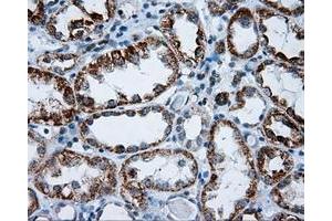 Immunohistochemical staining of paraffin-embedded Kidney tissue using anti-RIC8A mouse monoclonal antibody. (RIC8A 抗体)