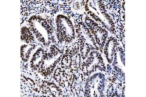 IHC analysis of HDAC2 using anti-HDAC2 antibody (ABIN7601564). (HDAC2 抗体  (AA 387-488))