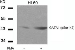 Western blot analysis of extracts from HL60 cells untreated or treated with PMA using GATA1(Phospho-Ser142) Antibody. (GATA1 抗体  (pSer142))