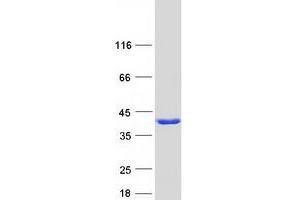 Validation with Western Blot