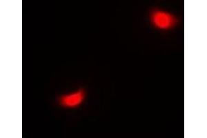 Immunofluorescent analysis of SETD6 staining in A549 cells. (SETD6 抗体)