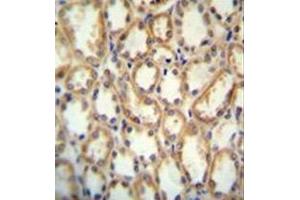 Immunohistochemistry (Paraffin-embedded Sections) (IHC (p)) image for anti-Potassium Channel, Subfamily T, Member 2 (KCNT2) (AA 1076-1105), (C-Term) antibody (ABIN953018)