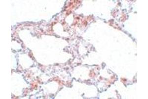 Immunohistochemistry (IHC) image for anti-MRE11 Meiotic Recombination 11 Homolog A (S. Cerevisiae) (MRE11A) (N-Term) antibody (ABIN1031460)