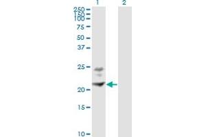 Western Blot analysis of BST2 expression in transfected 293T cell line by BST2 monoclonal antibody (M02), clone 3H4. (BST2 抗体  (AA 40-180))
