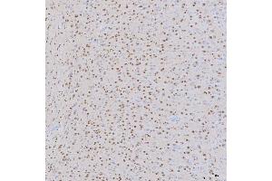 IHC analysis of SNRNP200 using anti-SNRNP200 antibody (ABIN7602032). (SNRNP200 抗体  (AA 557-2129))