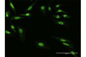 Immunofluorescence of purified MaxPab antibody to ZNF668 on HeLa cell. (ZNF668 抗体  (AA 1-619))