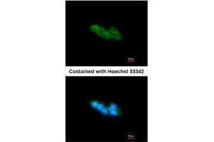 ICC/IF Image Immunofluorescence analysis of methanol-fixed HepG2, using ARMET, antibody at 1:200 dilution. (MANF 抗体)