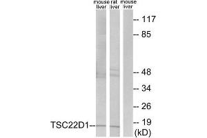 Western Blotting (WB) image for anti-TSC22 Domain Family, Member 1 (TSC22D1) (N-Term) antibody (ABIN1849646) (TSC22D1 抗体  (N-Term))
