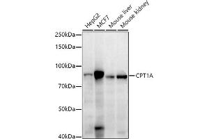 Western blot analysis of extracts of various cell lines, using CPT1A antibody (ABIN7266089) at 1:1000 dilution.