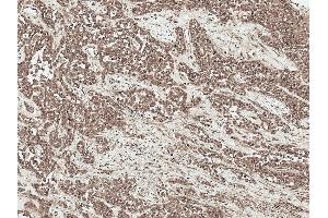 Immunohistochemistry analysis using Rabbit Anti-SFRP2 Polyclonal Antibody (ABIN5696096). (SFRP2 抗体  (AA 195-295) (HRP))