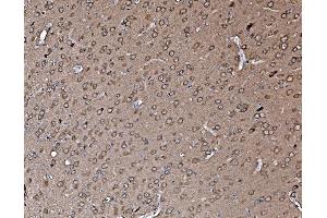 IHC analysis of Profilin 2/PFN2 using anti-Profilin 2/PFN2 antibody (ABIN7602692).