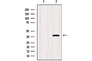 Western blot analysis of extracts from Myeloma cells, using SEPT9 Antibody. (Septin 9 抗体  (C-Term))
