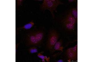 Immunofluorescence staining of methanol-fixed Hela cells using JunB(Phospho-Ser79) Antibody. (JunB 抗体  (pSer79))