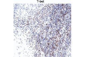 T-bet staining of human tonsil. (T-Bet 抗体)