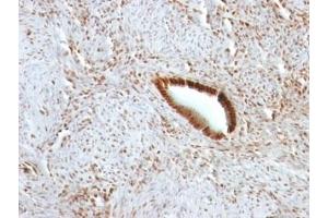 Formalin-fixed, paraffin-embedded human uterus stained with Nucleolin antibody. (Nucleolin 抗体)