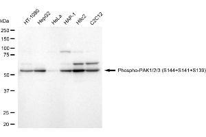 Western blotting analysis using phospho-PAK1/2/3 (S144+S141+S154) antibody (ABIN7799720).