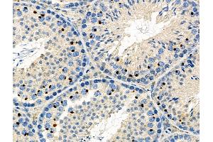 ABIN6266054 and ABIN6276599 at 1/100 staining Mouse testis tissue by IHC-P. (WT1 抗体  (N-Term))