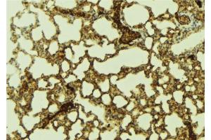 ABIN6274290 at 1/100 staining Mouse lung tissue by IHC-P. (PTTG1IP 抗体  (C-Term))