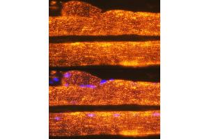 Immunofluorescence analysis of Rat skeletal muscle using Calsequestrin 1 antibody (ABIN7266045) at dilution of 1:100. (Calsequestrin 抗体)