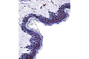 Tyrosinase Antibody immunohistochemistry analysis in formalin fixed and paraffin embedded human skin tissue followed by peroxidase conjugation of the secondary antibody and DAB staining. (TYR 抗体  (C-Term))
