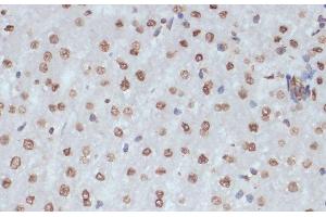 Immunohistochemistry (Paraffin-embedded Sections) (IHC (p)) image for anti-Cyclin-Dependent Kinase 1 (CDK1) (pTyr15) antibody (ABIN7265020)