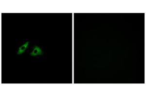 Immunofluorescence analysis of HeLa cells, using GPR152 antibody. (GPR152 抗体  (Internal Region))