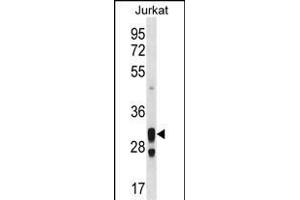 ACER1 Antibody (C-term) (ABIN1536908 and ABIN2850111) western blot analysis in Jurkat cell line lysates (35 μg/lane). (ACER1 抗体  (C-Term))