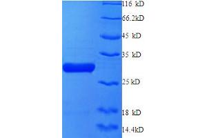 X-Ray Repair Complementing Defective Repair in Chinese Hamster Cells 6 (XRCC6) (AA 6-222), (partial) protein (His tag)