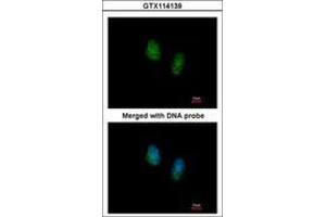 Image no. 3 for anti-RAN, Member RAS Oncogene Family (RAN) (AA 1-179) antibody (ABIN467626)