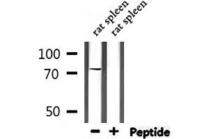 Western blot analysis of extracts from rat spleen, using GARS Antibody. (GARS 抗体  (C-Term))