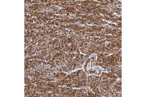 Immunohistochemical staining of human smooth muscle with SLMAP polyclonal antibody  shows strong nuclear and cytoplasmic positivity in smooth muscle cells.