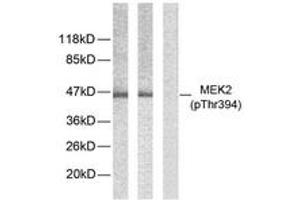 Western blot analysis of extracts from ovary cancer, using MEK2 (Phospho-Thr394) Antibody. (MEK2 抗体  (AA 261-310))