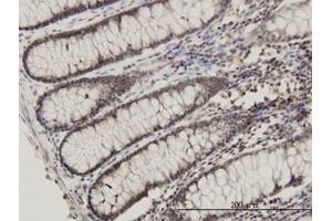 Image no. 1 for anti-Ribosomal Protein L14 (RPL14) (AA 1-91) antibody (ABIN465975) (RPL14 抗体  (AA 1-91))