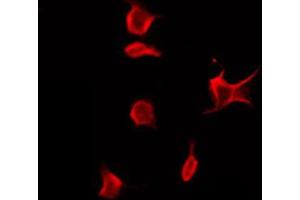 ABIN6272382 staining A549 by IF/ICC. (PDE10A 抗体  (N-Term))