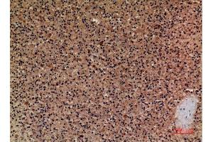 Immunohistochemistry (IHC) image for anti-Cerberus 1 Homolog (Xenopus Laevis) (CER1) (Internal Region) antibody (ABIN3187912)