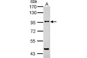 Western Blotting (WB) image for anti-Transforming Growth Factor, beta Receptor III (TGFBR3) (N-Term) antibody (ABIN2856649)