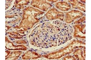 Immunohistochemistry (IHC) image for anti-Solute Carrier Family 5 (Sodium/glucose Cotransporter), Member 1 (SLC5A1) (AA 564-643) antibody (ABIN7170011)