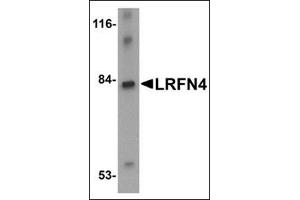 Western blot analysis of LRFN4 in rat brain lysate with this product at 1 μg/ml. (LRFN4 抗体  (C-Term))