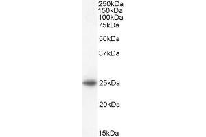 ABIN184699 staining (2µg/ml) of Human Adrenal Gland lysate (35µg protein in RIPA buffer). (BAK1 抗体  (N-Term))