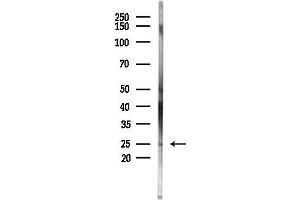 Western blot analysis of lysates from HepG2 cells(starvation,24h treatment), using Phospho-eIF4E (Thr55) Antibody at 1/1000 dilution.