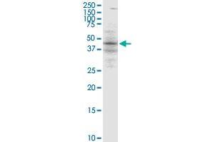 BLNK monoclonal antibody (M04), clone 1D7.