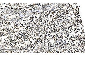 IHC analysis of Bim/BCL2L11 using anti-Bim/BCL2L11 antibody (ABIN7602855).