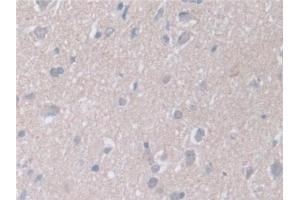 Immunohistochemistry (IHC) image for anti-Retinoic Acid Receptor, alpha (RARA) (AA 68-173) antibody (ABIN7432958)