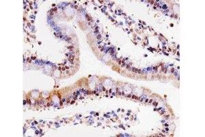 IHC testing of paraffin-embedded rat small intestine using Cdk4 antibody at 1:25. (CDK4 抗体  (AA 272-303))